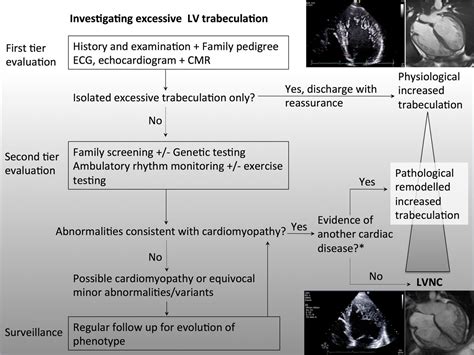 lv cardiomyopathy|noncompaction cardiomyopathy guidelines.